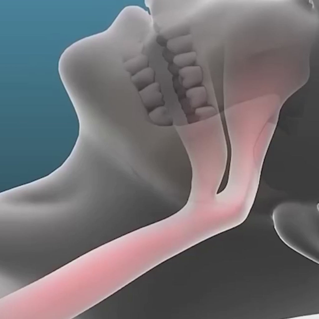 Original CloudKissen