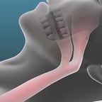 Original CloudKissen